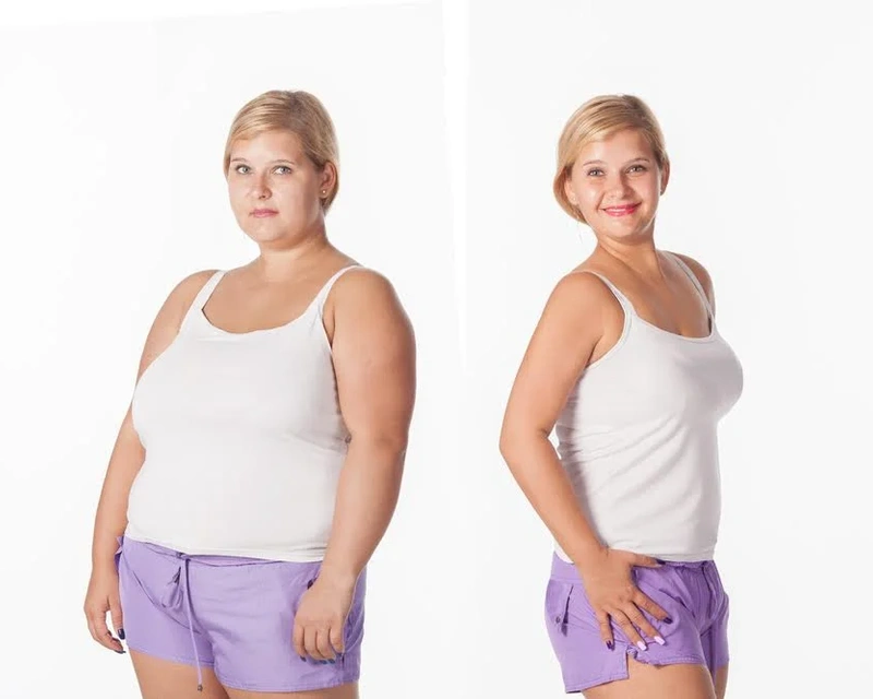 TYPES OF BARIATRIC SURGERY